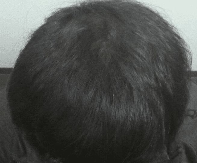 男性実績例 アフター