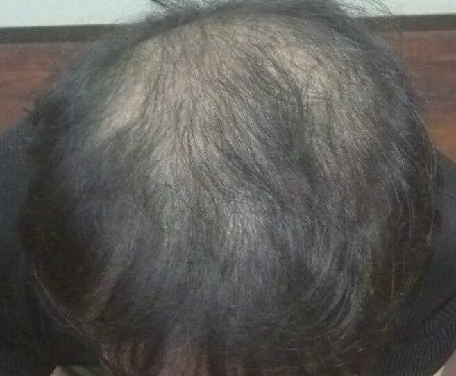 男性実績例 ビフォー